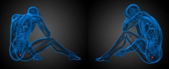 Testimonio Persona con Prostata